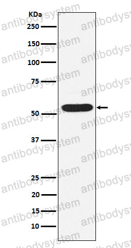 Anti-PIAS2 Antibody (R1F81)