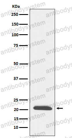 Anti-DCTN3 Antibody (R1F82)