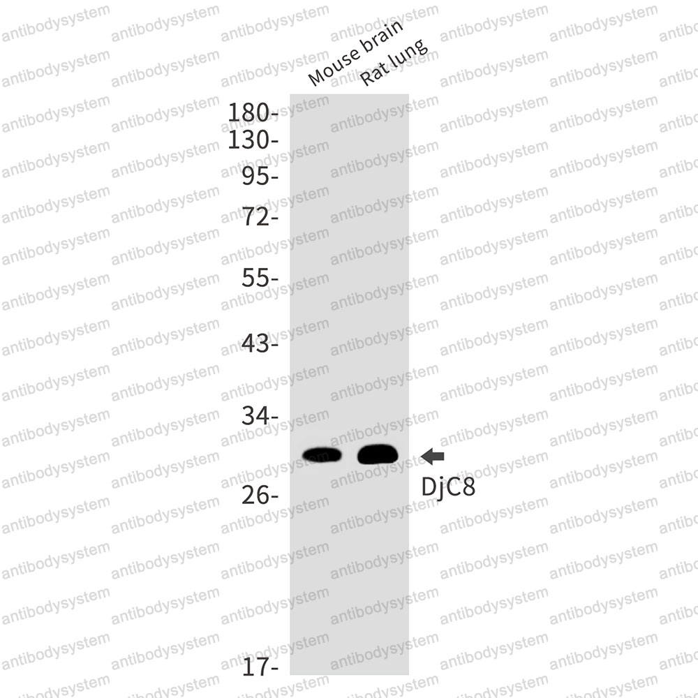 Anti-DNAJC8 Antibody (R1F83)