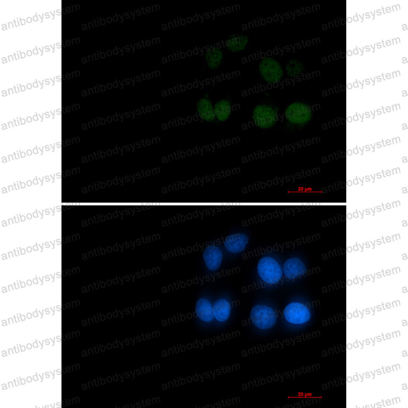 Anti-Phospho-RAD17 (Ser656) Antibody (R1F85)