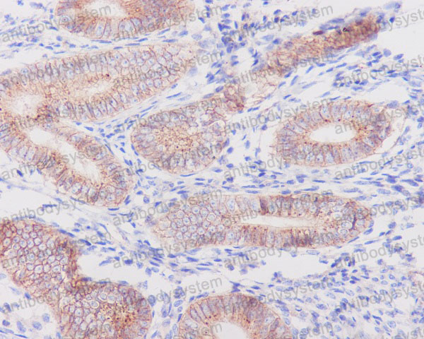 Anti-FLOT1 Antibody (R1B06)