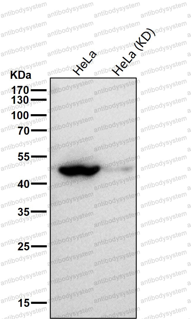 Anti-FLOT1 Antibody (R1B08)