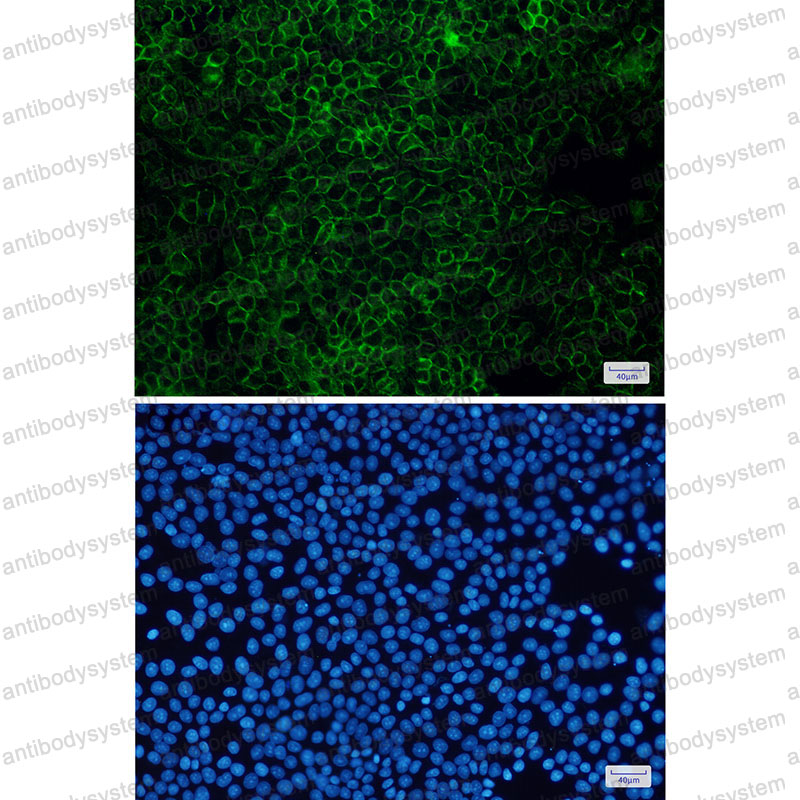Anti-FLOT1 Antibody (R1F86)