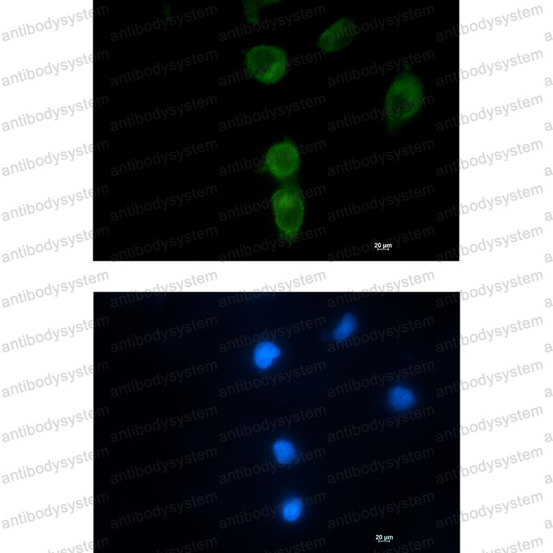 Anti-CLPX Antibody (R1F88)