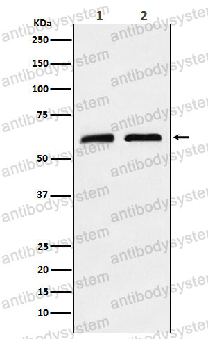 Anti-CLPX Antibody (R1F87)