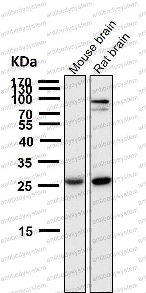 Anti-SCGN Antibody (R1F89)