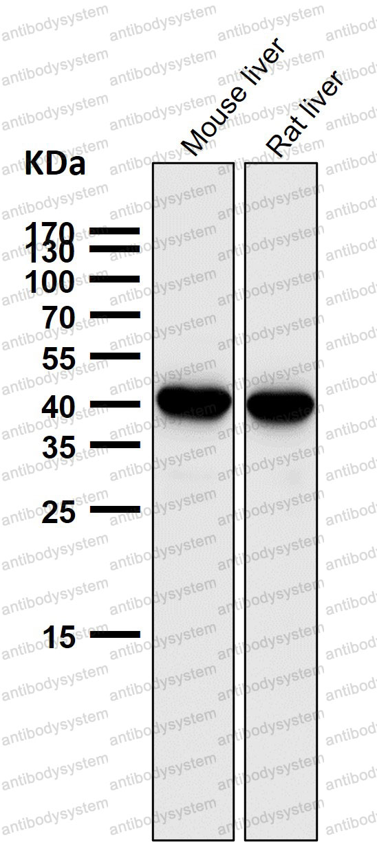 Anti-SEC14L2/TAP Antibody (R1B74)
