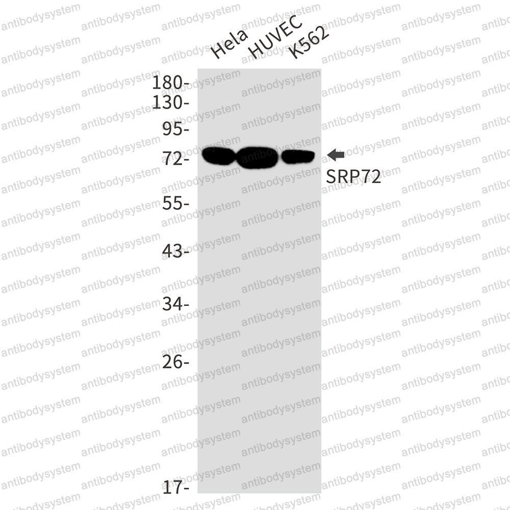 Anti-SRP72 Antibody (R1F91)