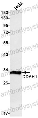 Anti-DDAH1 Antibody (R1F93)