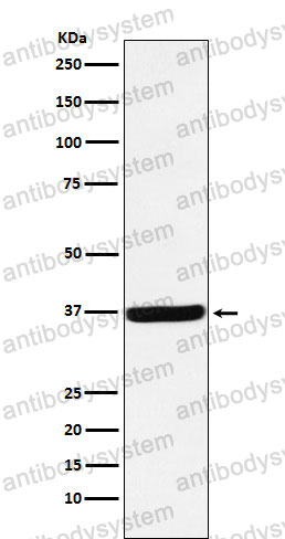 Anti-DDAH1 Antibody (R1F92)