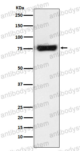 Anti-MTA2 Antibody (R1F94)