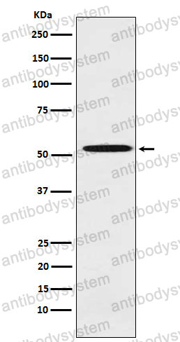 Anti-ALDH1A2 Antibody (R1F95)