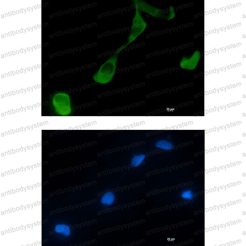 Anti-GFPT2 Antibody (R1F96)