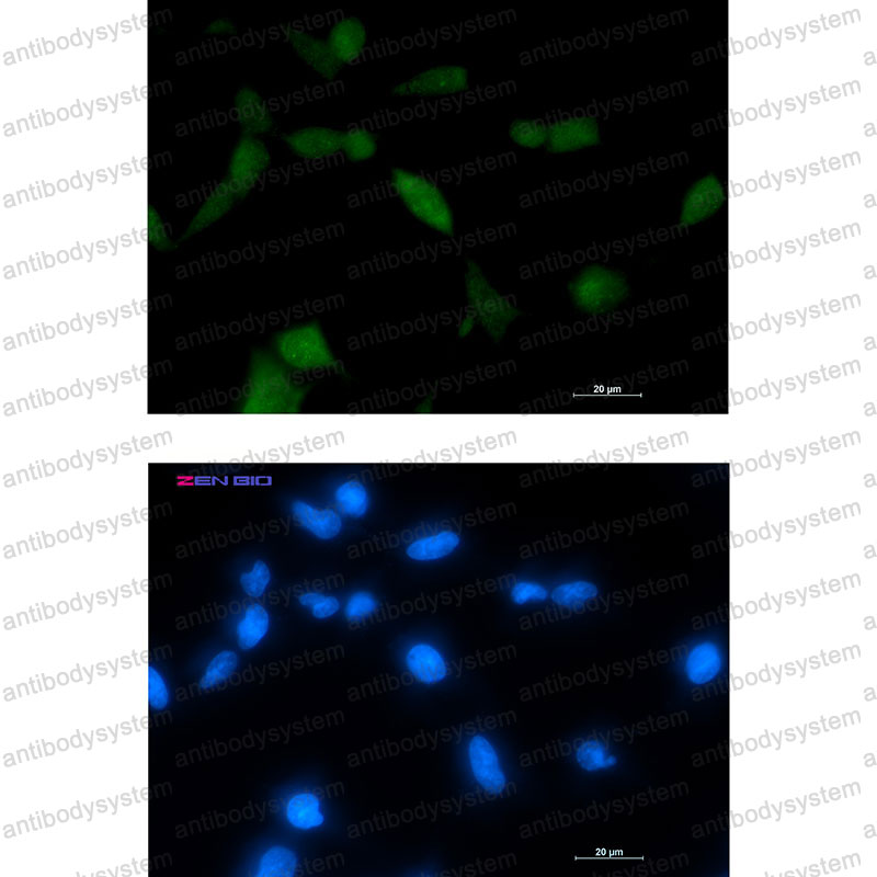 Anti-TPPP Antibody (R1F98)