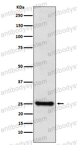 Anti-TPPP Antibody (R1F97)