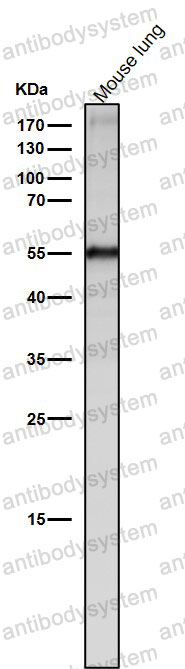 Anti-SLIT2 Antibody (R1F99)