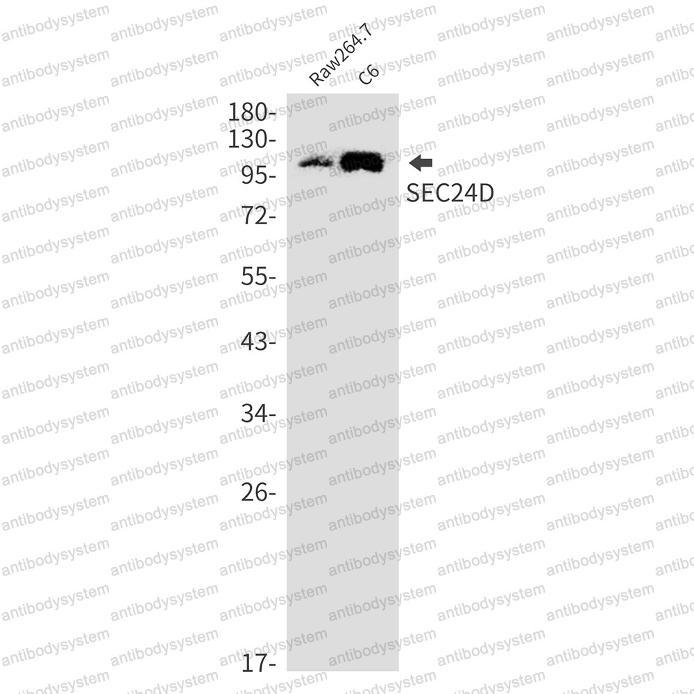 Anti-SEC24D Antibody (R1G05)