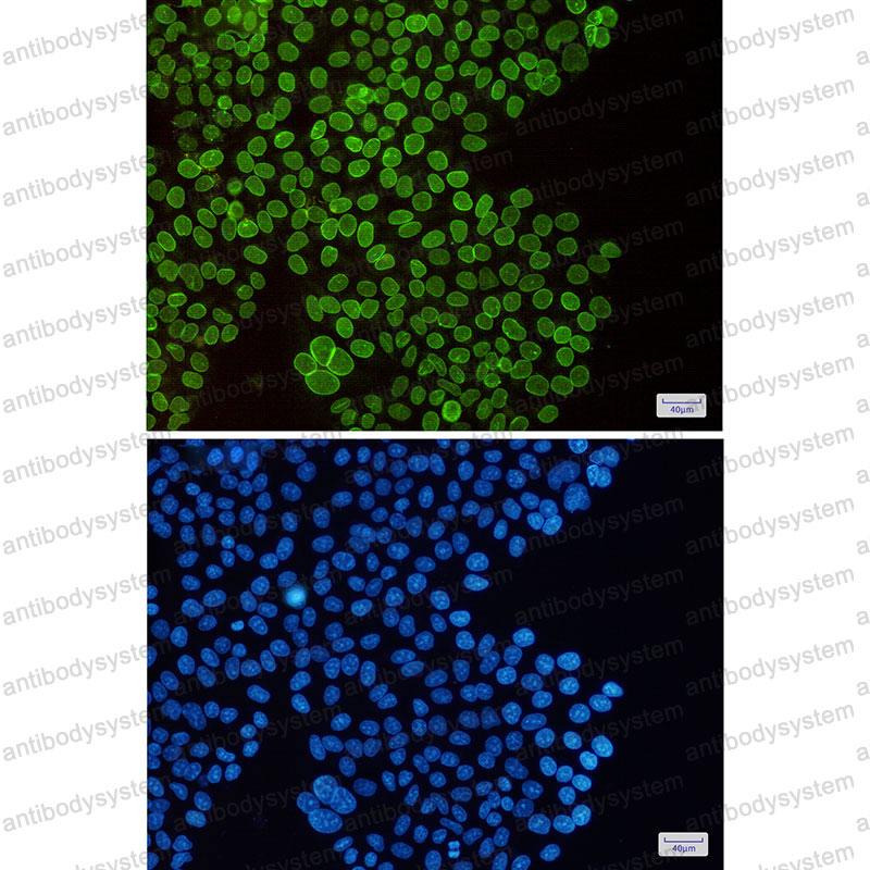 Anti-SUN1 Antibody (R1G08)