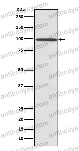 Anti-SUN1 Antibody (R1G07)