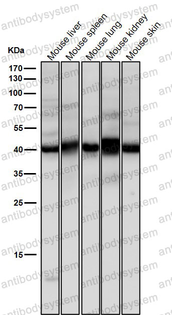 Anti-ERLIN2 Antibody (R1G09)
