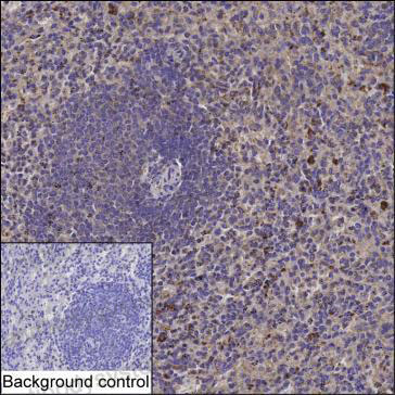 Immunohistochemical for Anti-NFAT5 Antibody (R2W08) ?>