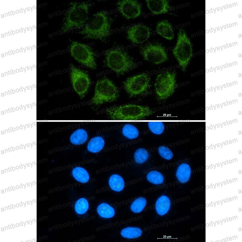 Anti-GLS Antibody (R1G11)