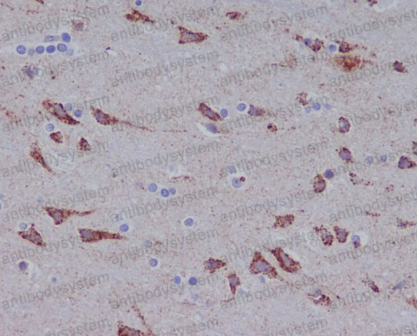 Anti-GLS Antibody (R1G10)