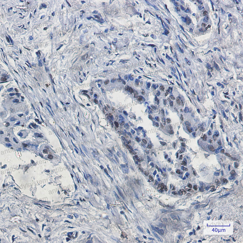 Anti-KDM4B Antibody (R1G12)