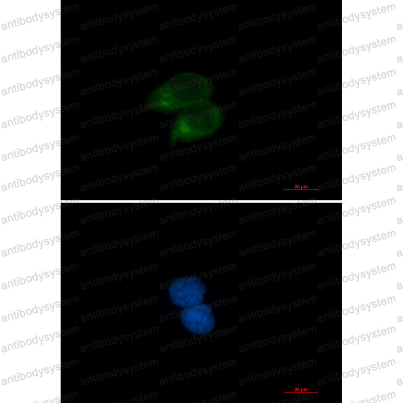 Anti-CLSTN1 Antibody (R1G14)