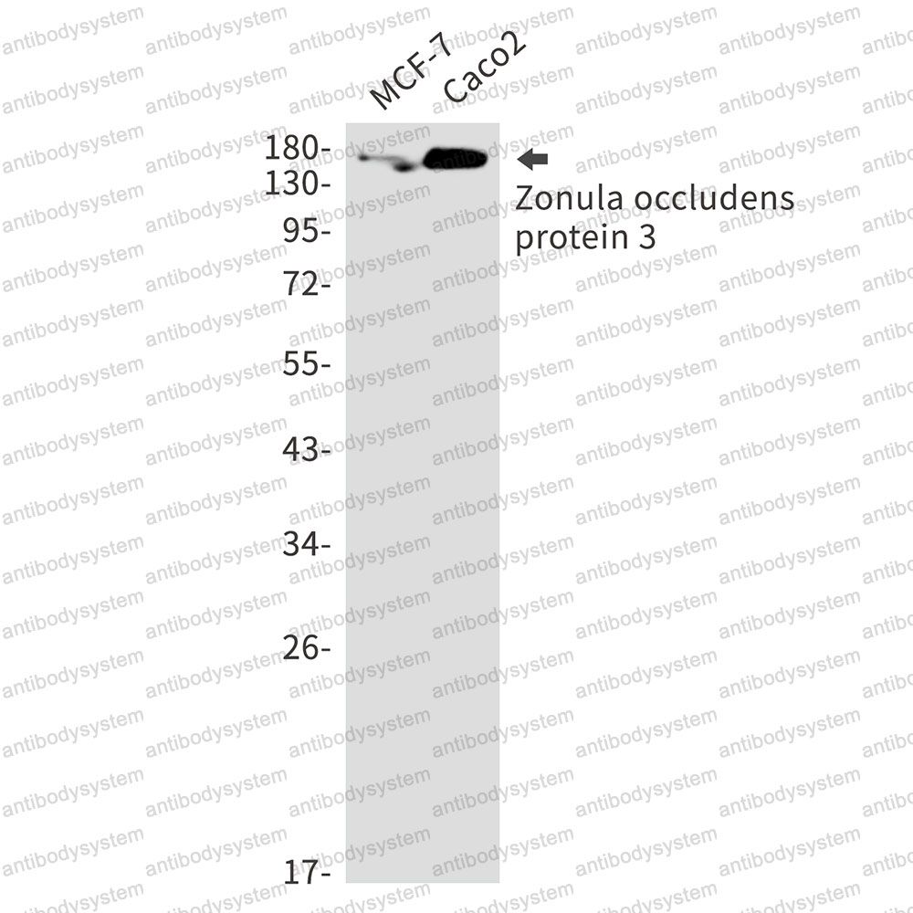 Anti-TJP3 Antibody (R1G15)