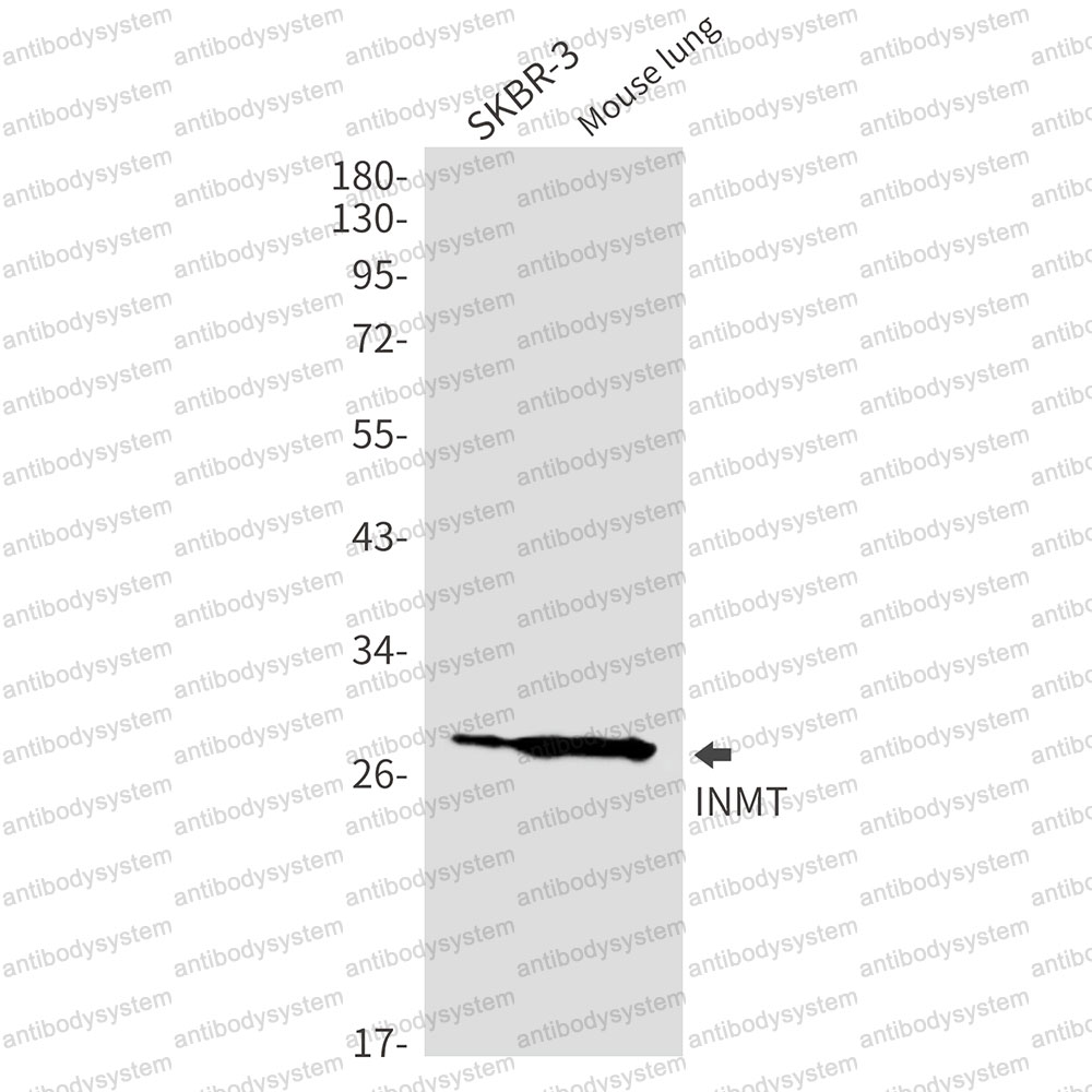 Anti-INMT Antibody (R1G18)