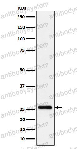 Anti-INMT Antibody (R1G17)