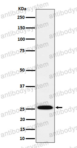 Anti-INMT Antibody (R1G16)
