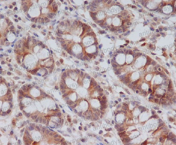 Anti-CCNB2 Antibody (R1G19)