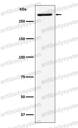 Anti-UBR5 Antibody (R1G20)