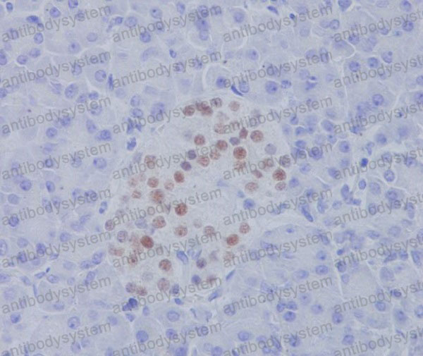 Anti-NKX2-2 Antibody (R1G21)