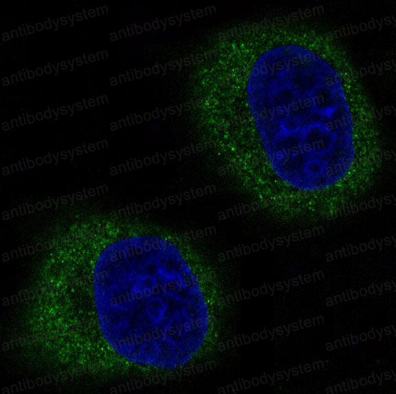 Anti-MFN2 Antibody (R1G22)