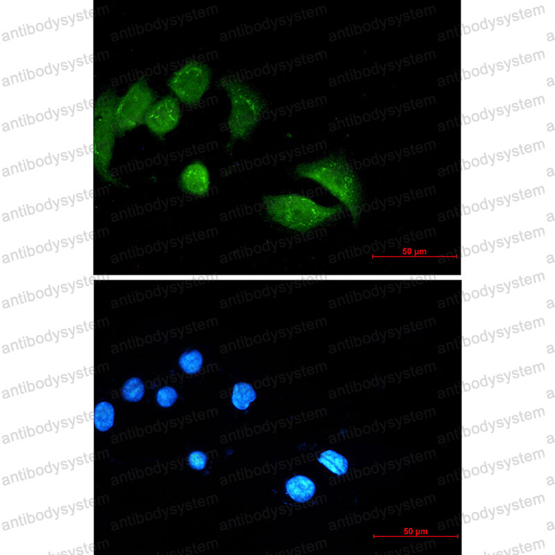 Anti-UBE4B Antibody (R1G24)