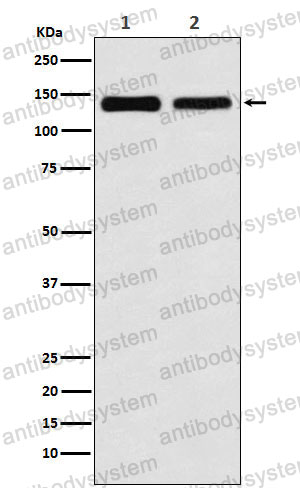 Anti-UBE4B Antibody (R1G23)