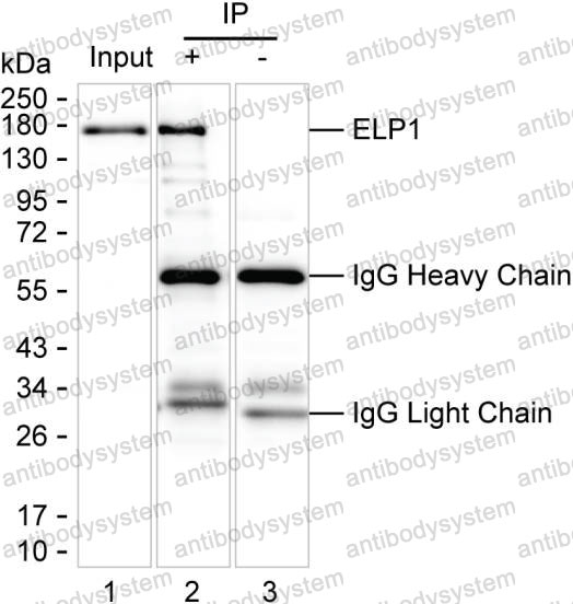 Anti-ELP1 Antibody (R2W17)