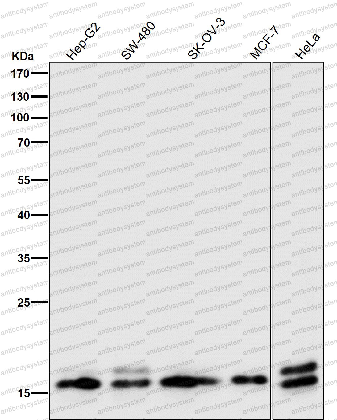 Anti-GABARAP Antibody (R1G25)