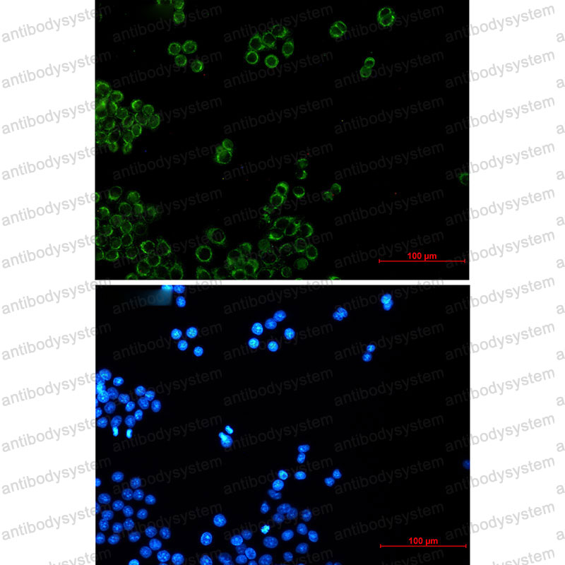 Anti-NDUFB4 Antibody (R1G27)