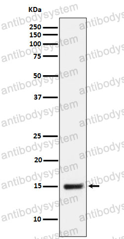 Anti-NDUFB4 Antibody (R1G26)