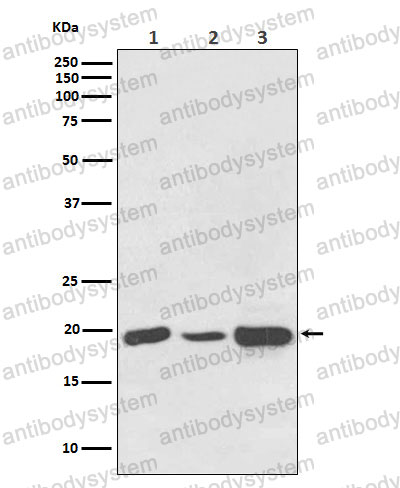 Anti-NDUFB8 Antibody (R1G28)