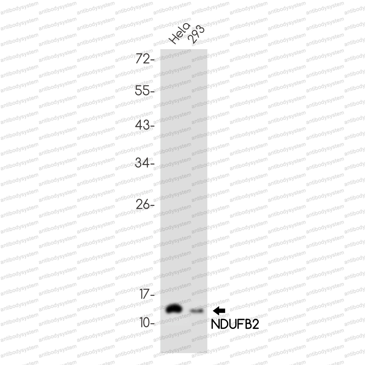 Anti-NDUFB2 Antibody (R1G29)