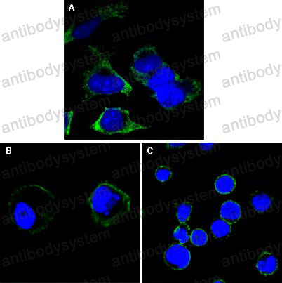 Immunofluorescence for Anti-RTN3 Antibody (R2W20) ?>
