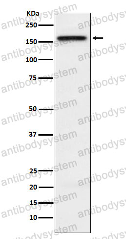 Anti-KIF4A Antibody (R1G32)