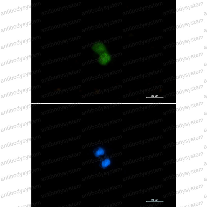 Anti-KAT7 Antibody (R1G33)