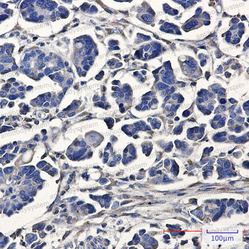 Anti-ATE1 Antibody (R1G35)