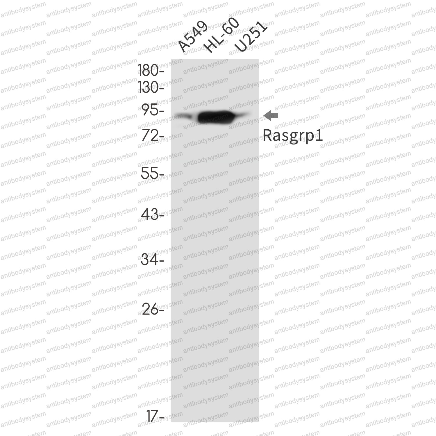 Anti-RASGRP1 Antibody (R1G36)